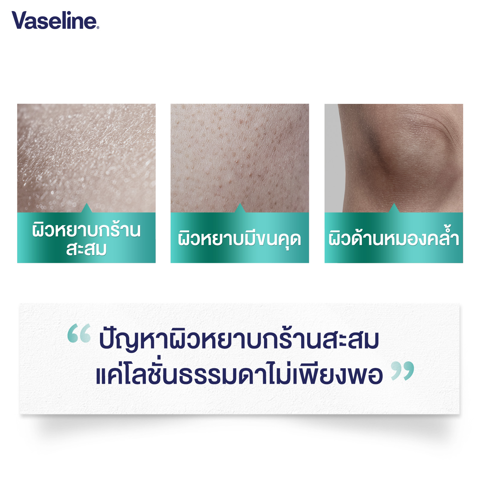 [อยู่ระหว่างเปลี่ยนบรรจุภัณฑ์] วาสลีน โปร เดอร์มา โลชั่น บอดี้แอมพูล ...