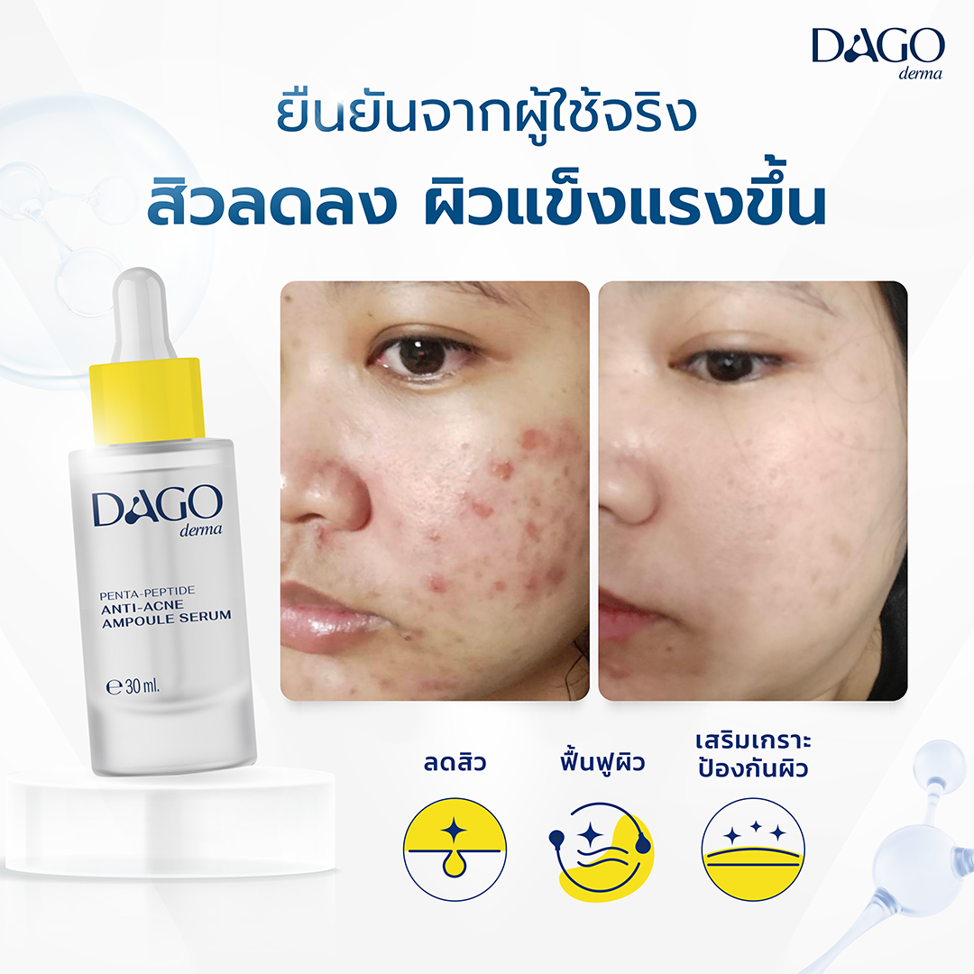 [Set 3 ชิ้น] เซรั่มลดสิว Dagoderma ลดรอยสิว ผลัดเซลล์ผิว Penta-peptide ...
