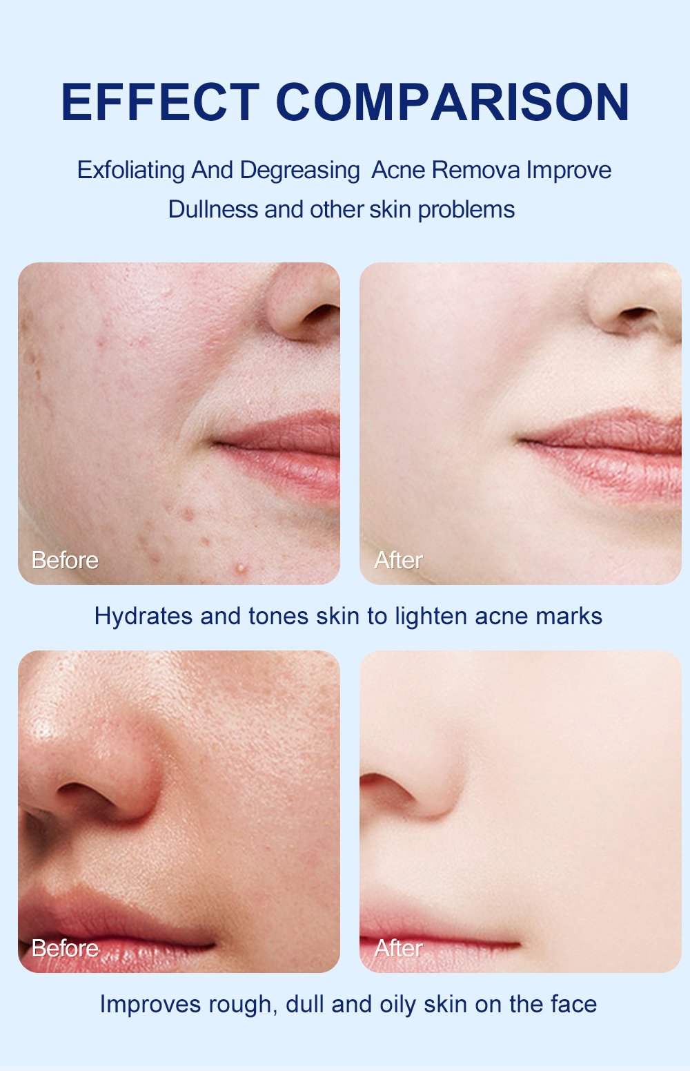 MOOYAM คลีนเซอร์ คลีนเซอร์กรดซาลิไซลิก Salicylic Acid Daily Gentle ...
