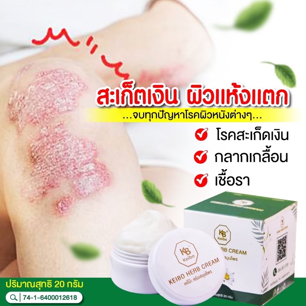 ครีมสมุนไพรเคโบ๊ะ Keibo ขนาด 20 กรัม คัน เชื้อรา กากเกลื้อน ผื่นคัน ...