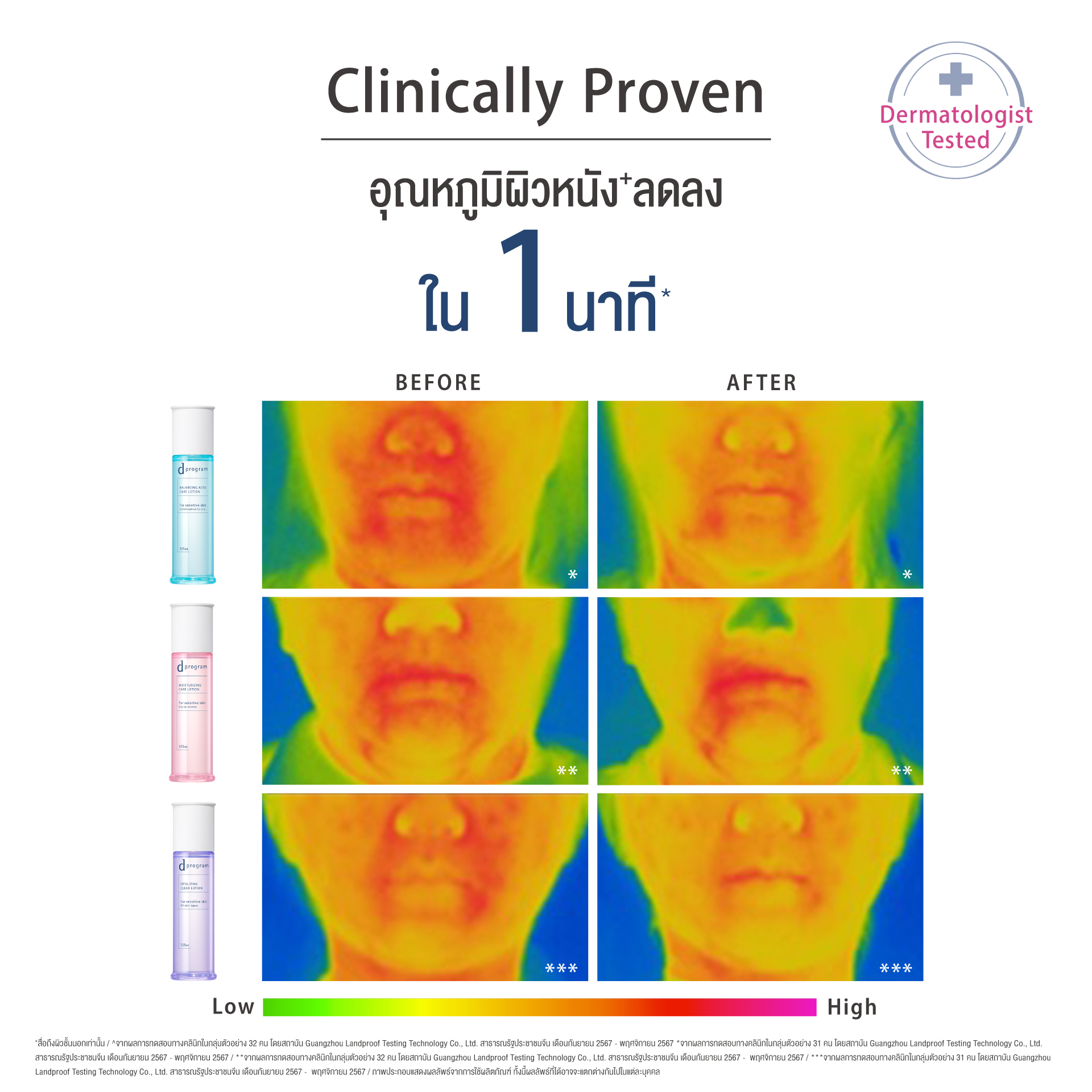 [สูตรใหม่!] d program ดี โปรแกรม บาลานซิ่ง แอคเน่ แคร์ อิมัลชั่น 100 mL ...