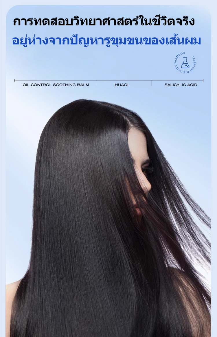 SIMU แชมพูขจัดรังแคที่มีประสิทธิภาพ Refreshing Anti-itch Oil Control ...