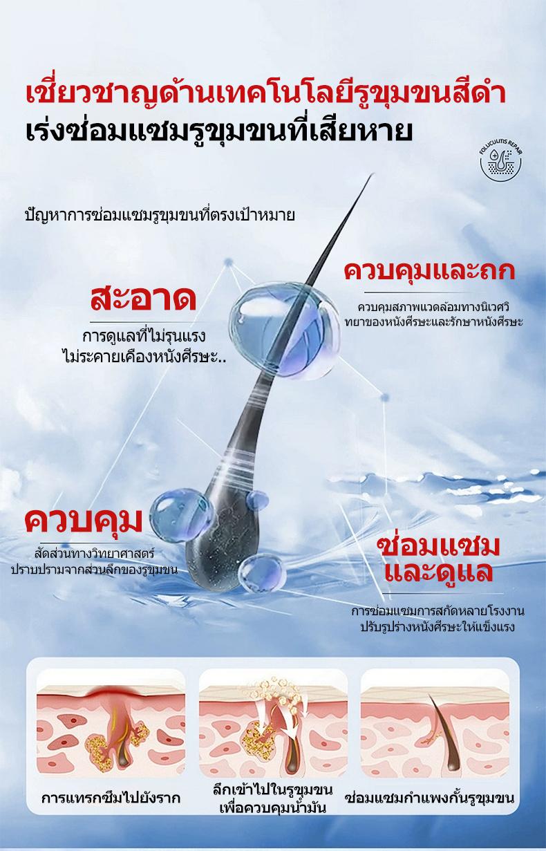 SIMU แชมพูขจัดรังแค 300ml ซื้อ1แถม1 ซีลีเนียมไดซัลไฟด์ Anti-itch Oil ...