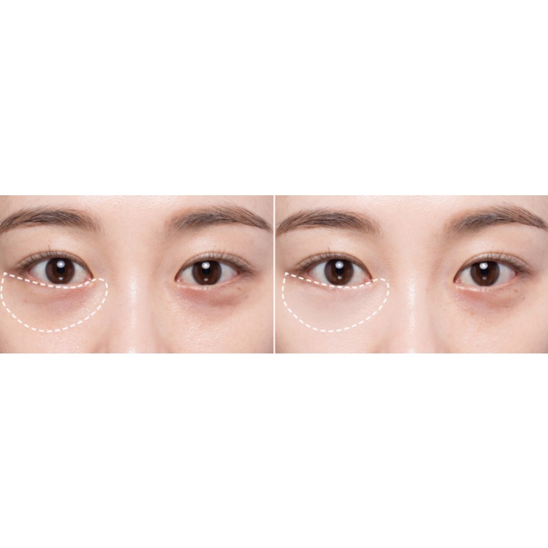 clio-คอนซีลเลอร์-แบบโปร่งใส-3-กรัม